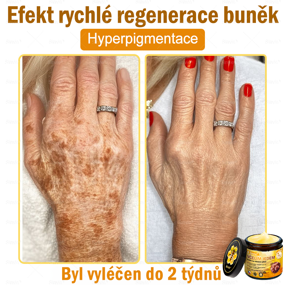 👨⚕Sinvie® Krém na obnovu pleti s včelím jedem(👨⚕CE schváleno)👍✅