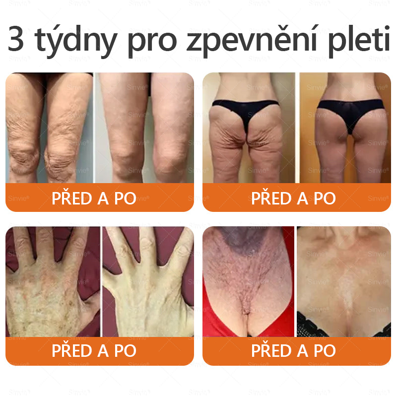 👨⚕Sinvie® Krém na obnovu pleti s včelím jedem(👨⚕CE schváleno)👍✅
