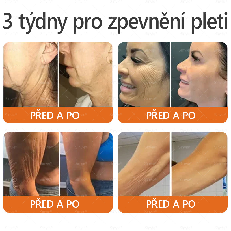 🧑⚕️Doporučení dermatologa 🐝 Sinvie® Včelím Jedem Krém na Opravu Pokožky 🔥 Český vývoj, výroba a dodávka v České republice