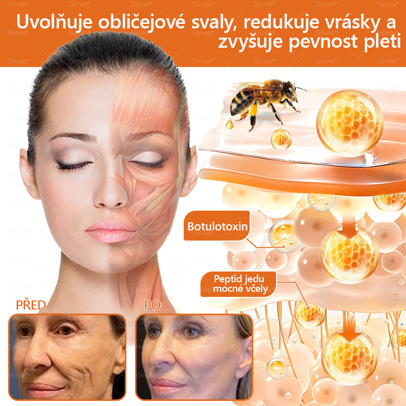 🧑⚕️Doporučení dermatologa 🐝 Sinvie® Včelím Jedem Krém na Opravu Pokožky 🔥 Český vývoj, výroba a dodávka v České republice