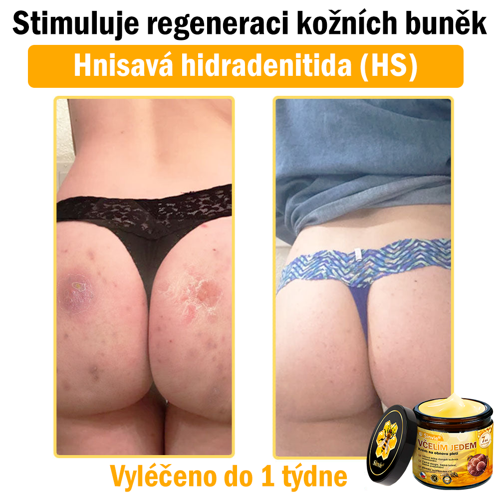 👨⚕Sinvie® Krém na obnovu pleti s včelím jedem(👨⚕CE schváleno)👍✅