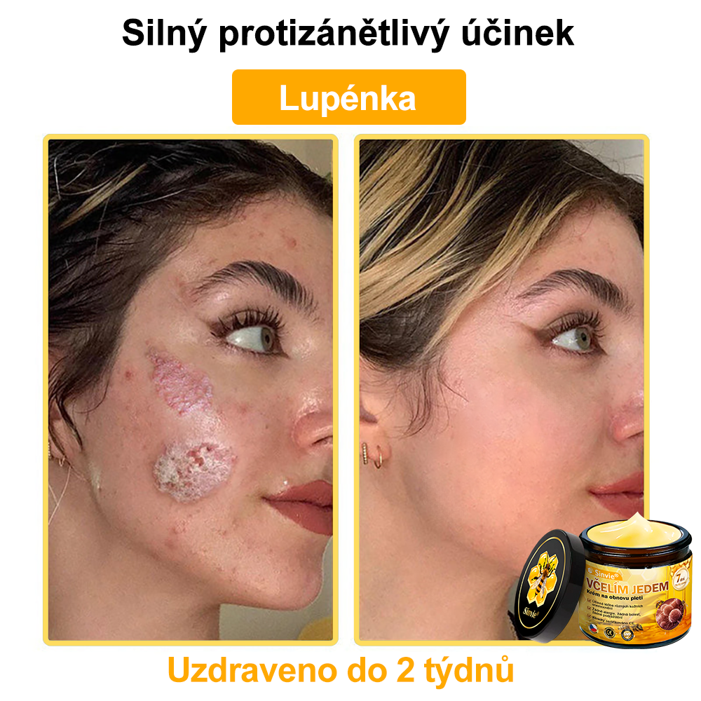 👨⚕Sinvie® Krém na obnovu pleti s včelím jedem(👨⚕CE schváleno)👍✅