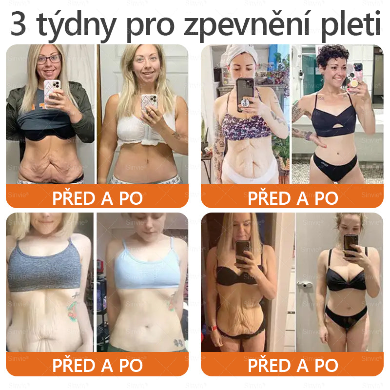 🧑‍⚕️Doporučení dermatologa 🐝 Sinvie® Včelím Jedem Krém na Opravu Pokožky (CE schváleno)👍✅