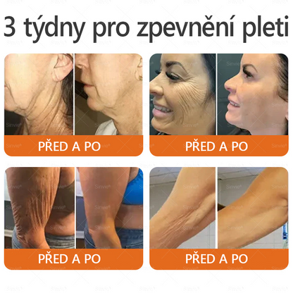🧑‍⚕️Doporučení dermatologa 🐝 Sinvie® Včelím Jedem Krém na Opravu Pokožky (CE schváleno)👍✅