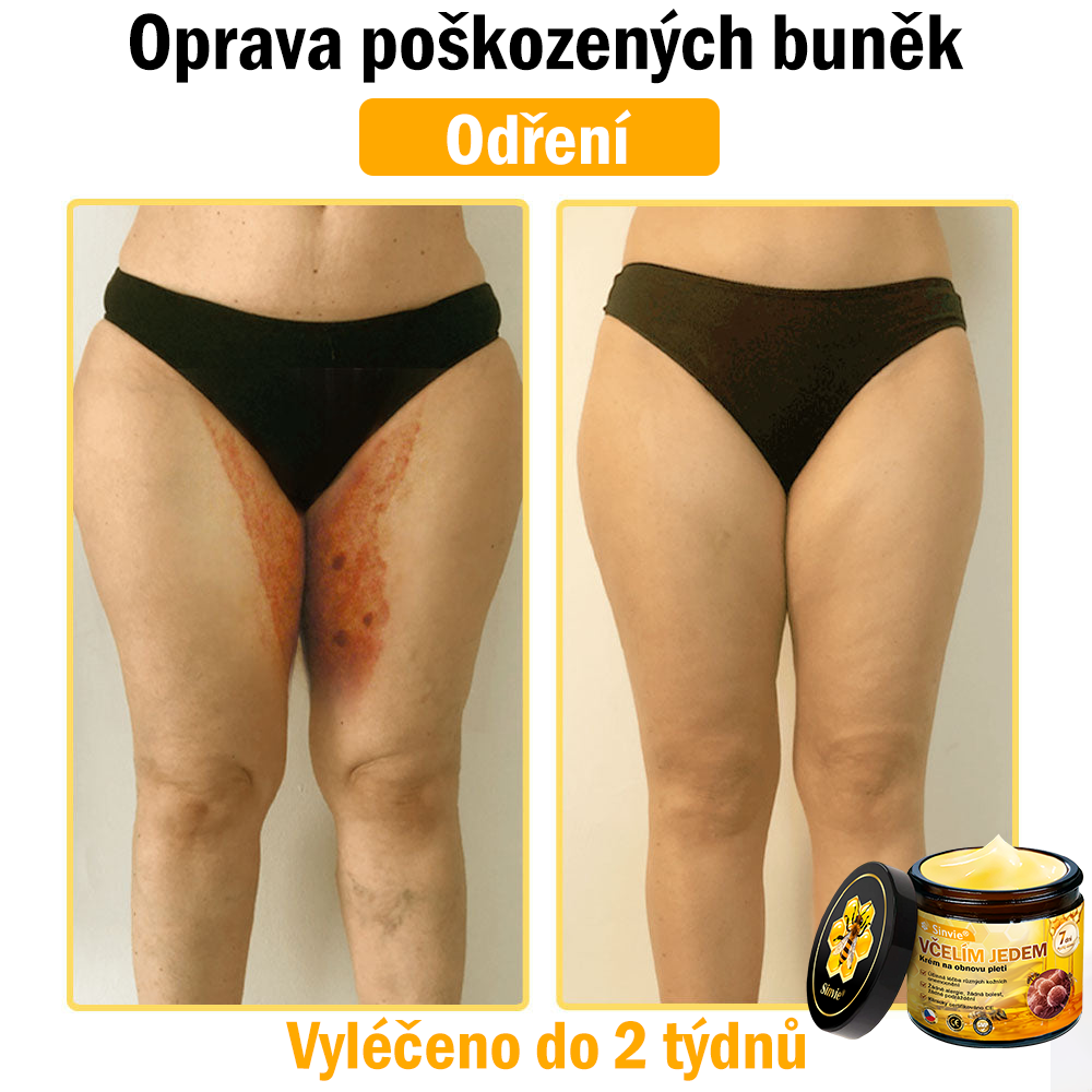 🐝👨‍⚕‍Sinvie® Krém na obnovu pleti s včelím jedem(👨‍⚕‍CE schváleno)👍✅