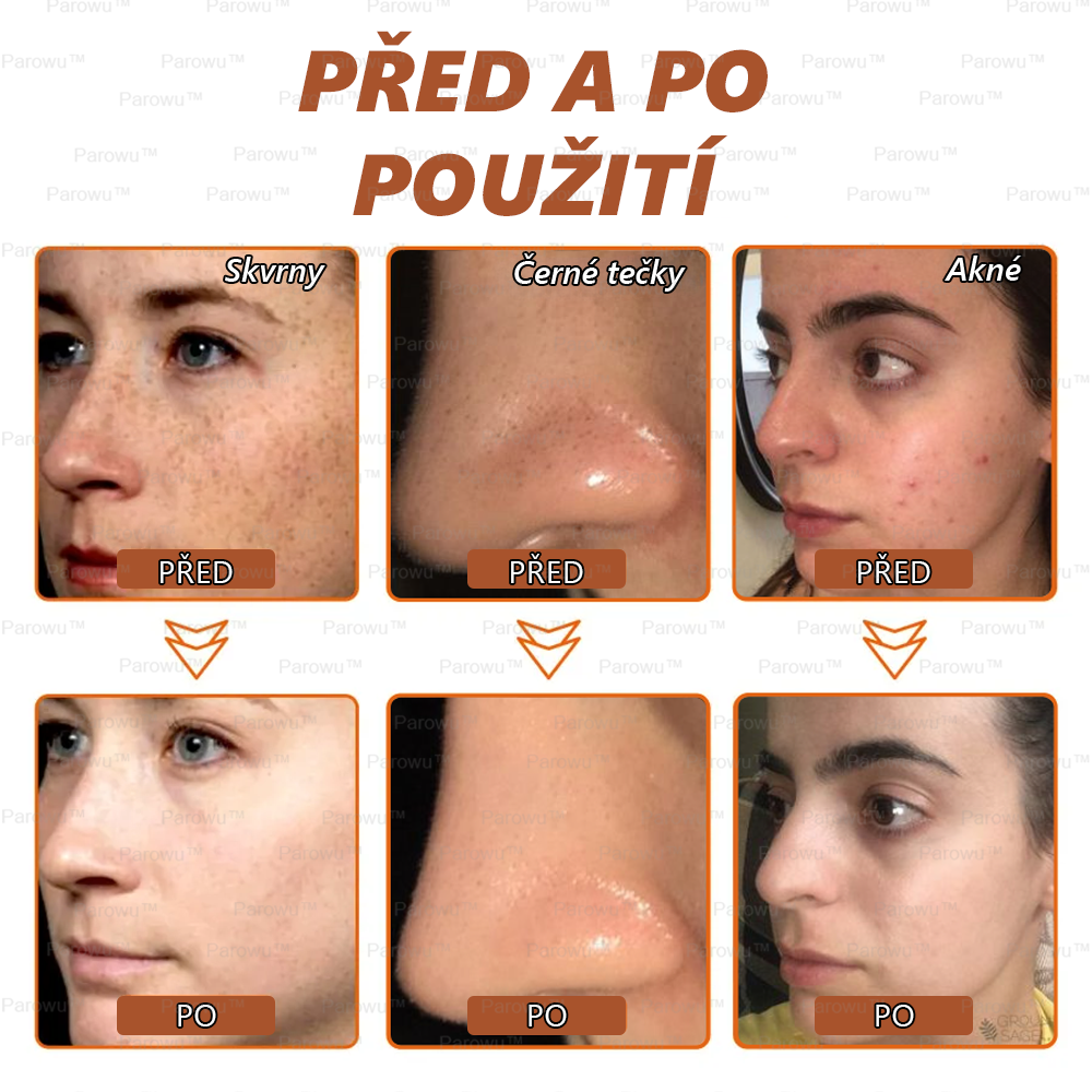𝗣𝗮𝗿𝗼𝘄𝘂™ Bělící a Odstraňující Skvrny Maska – Přírodní složky trvale odstraňují pigmentové skvrny, stařecké skvrny, pihy a sluneční skvrny.