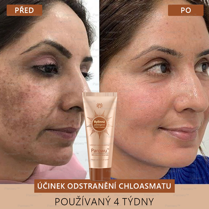 𝗣𝗮𝗿𝗼𝘄𝘂™ Bělící a Odstraňující Skvrny Maska – Přírodní složky trvale odstraňují pigmentové skvrny, stařecké skvrny, pihy a sluneční skvrny.
