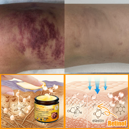 🐝👨‍⚕‍Sinvie® Krém na obnovu pleti s včelím jedem(👨‍⚕‍CE schváleno)👍✅