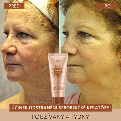 𝗣𝗮𝗿𝗼𝘄𝘂™ Bělící a Odstraňující Skvrny Maska – Přírodní složky trvale odstraňují pigmentové skvrny, stařecké skvrny, pihy a sluneční skvrny.