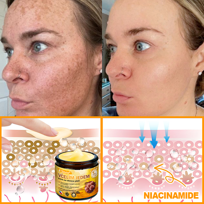 🐝👨‍⚕‍Sinvie® Krém na obnovu pleti s včelím jedem(👨‍⚕‍CE schváleno)👍✅