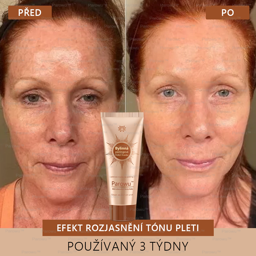 𝗣𝗮𝗿𝗼𝘄𝘂™ Bělící a Odstraňující Skvrny Maska – Přírodní složky trvale odstraňují pigmentové skvrny, stařecké skvrny, pihy a sluneční skvrny.